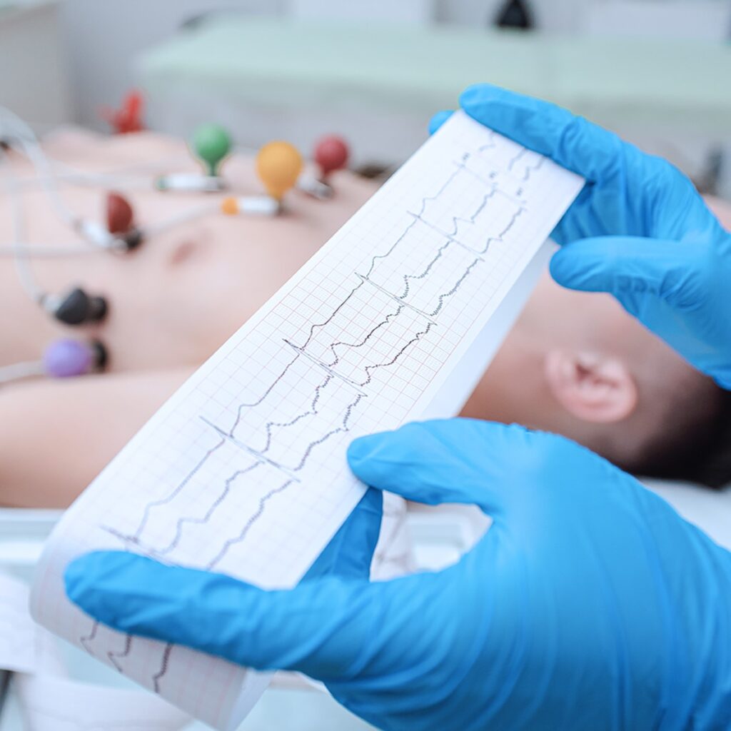 EKG technician holding Electrocardiogram test results